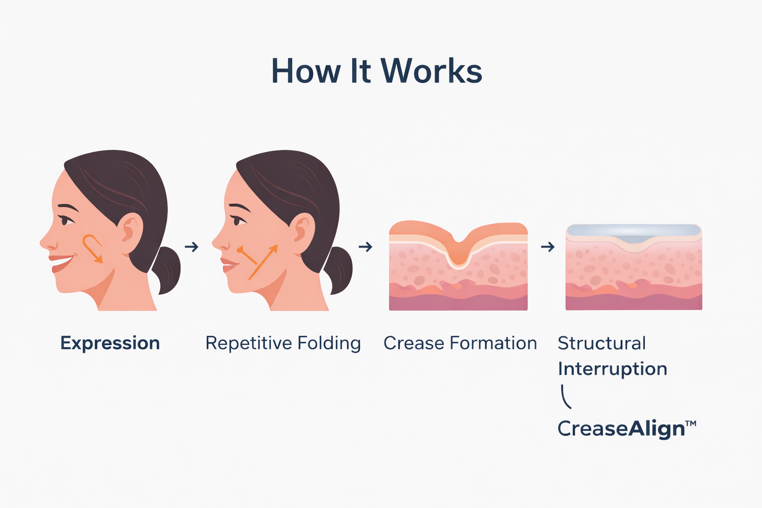 “Nasolabial Folds: Causes, Prevention & Treatment Guide”